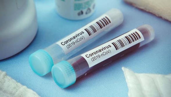 За сутки в Армении выявлено 230 новых случаев коронавируса, скончались еще 15 человек