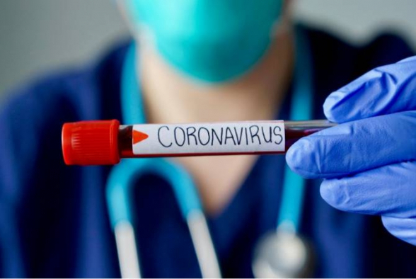 За сутки в Армении выявлено 34 новых случая коронавируса, скончались еще 3 человека