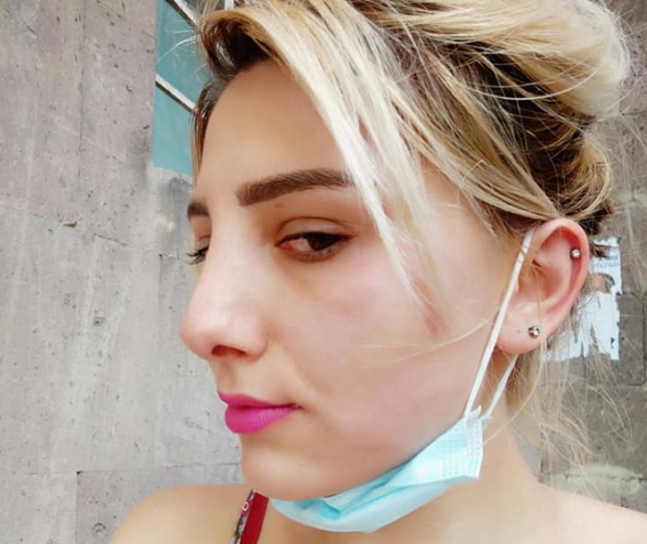 Группа сторонниц Никола Пашиняна напала на меня близ избирательного участка 10/25