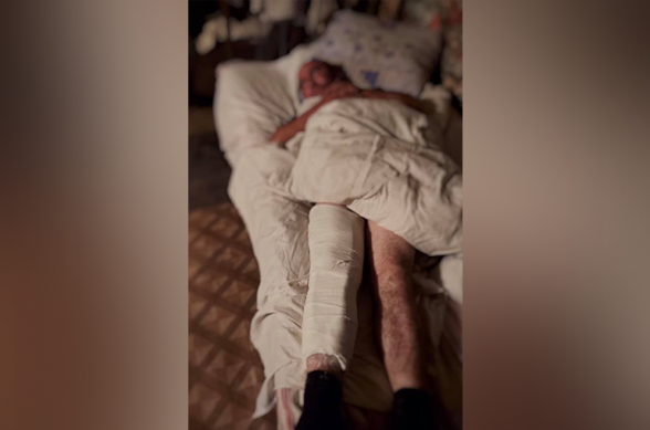 Մաճկալաշեն գյուղի գերեվարված բնակիչը Ադրբեջանի ԶՈՒ կողմից ծեծի ու անմարդկային վերաբերմունքի է ենթարկվել, վնասվել է ոտքը․ Արցախի ՄԻՊ