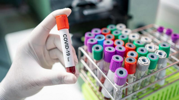 В Грузии выявлено 1 120 новых случаев коронавируса