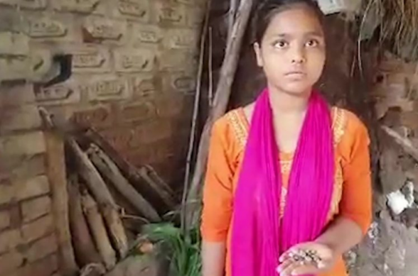 У девочки из Индии вместо слёз образуются камни