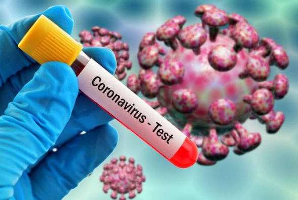 За сутки в Армении выявлено 1517 новых случаев коронавируса, скончались еще 59 человек