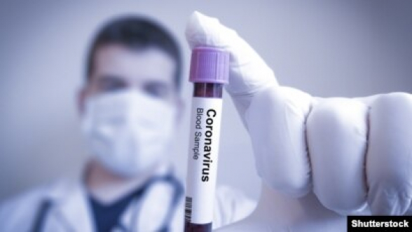 Արցախում կորոնավիրուսի 85 նոր դեպք է գրանցվել, 3 հիվանդ մահացել է