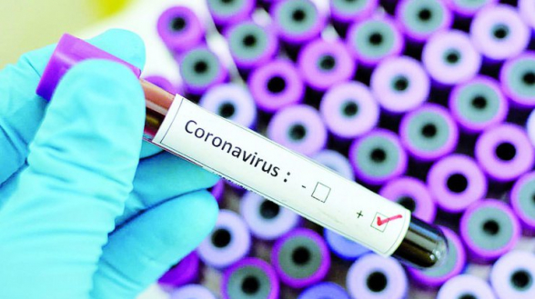 За сутки в Армении выявлено 558 новых случаев коронавируса, скончались еще 24 человека