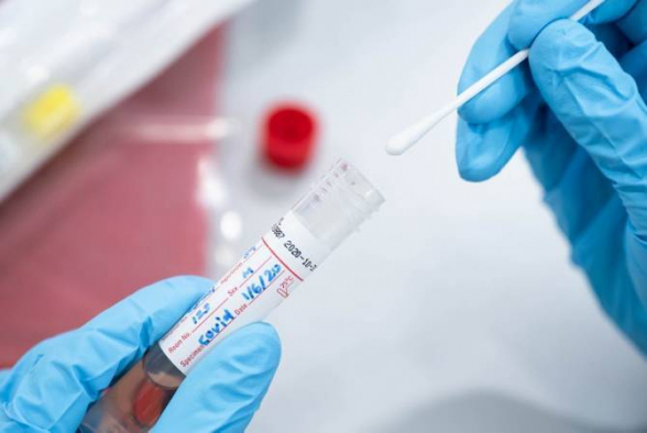 В Арцахе выявлено 3 новых случая заражения коронавирусом, скончались 4 человека
