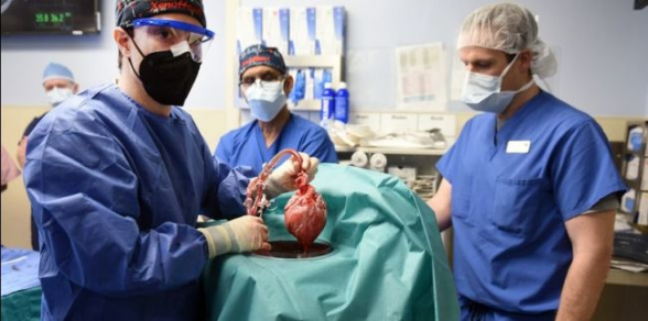 В США врачи впервые пересадили человеку сердце свиньи – NYT