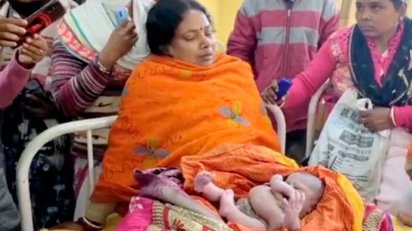 В Индии родился ребенок с восемью конечностями