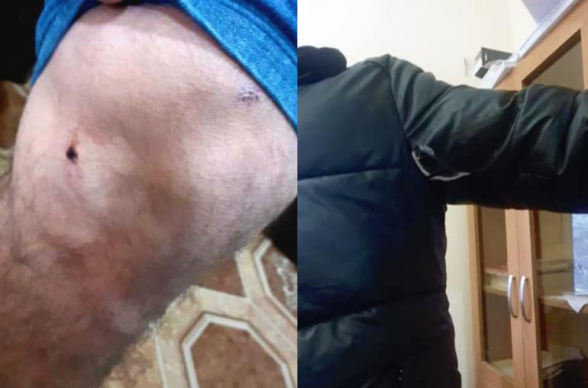 Азербайджанцы устроили очередную провокацию в Арцахе (фото)