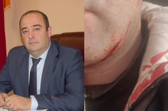 Ստեփանավանի ՔՊ-ական քաղաքապետը դանակով փորձել է կտրել քաղաքացու կոկորդը․ դեպքը տեղի է ունեցել քաղաքապետարանում (լուսանկար)