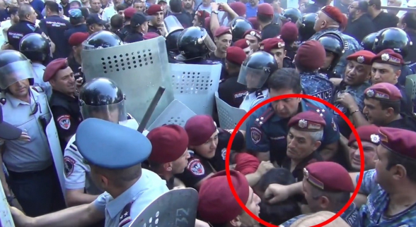 Այս բերետը բանտ չի՛ նստի՝ մազերը քաշելով երեխային դիտավորյալ ցավացնելու համար (տեսանյութ)